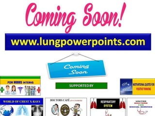 Bronchial Artery Embolization- By Dr.Tinku Joseph