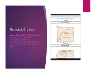 Reversibility test
Forced expiratory manoeuvres
before 20 minutes after
inhalation of a beta-2-
adrenoceptor agonist. Note the
increase in FEV1 from 1.0 to 2.5
litres.
 