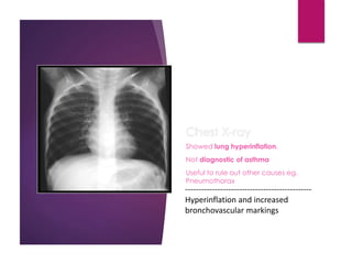 Chest X-ray
Showed lung hyperinflation.
Not diagnostic of asthma
Useful to rule out other causes eg.
Pneumothorax
-----------------------------------------------
Hyperinflation and increased
bronchovascular markings
 