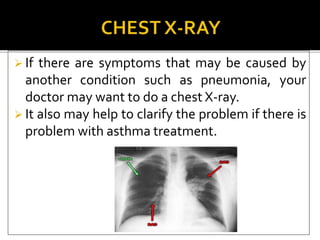  If there are symptoms that may be caused by
another condition such as pneumonia, your
doctor may want to do a chest X-ray.
 It also may help to clarify the problem if there is
problem with asthma treatment.
 