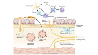 Bronchial asthma pathophysiology & classification of drugs | PPTX