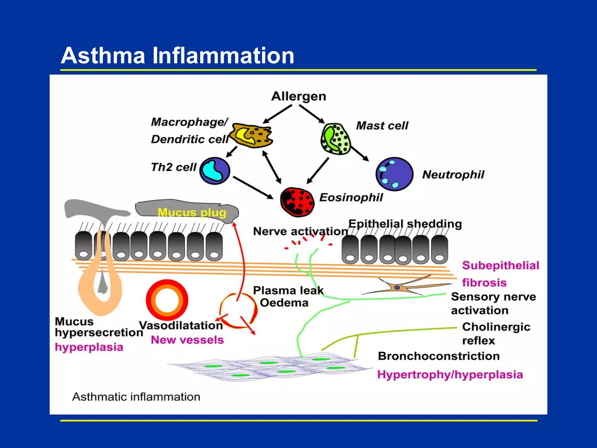 Asthma Inflammation
 
