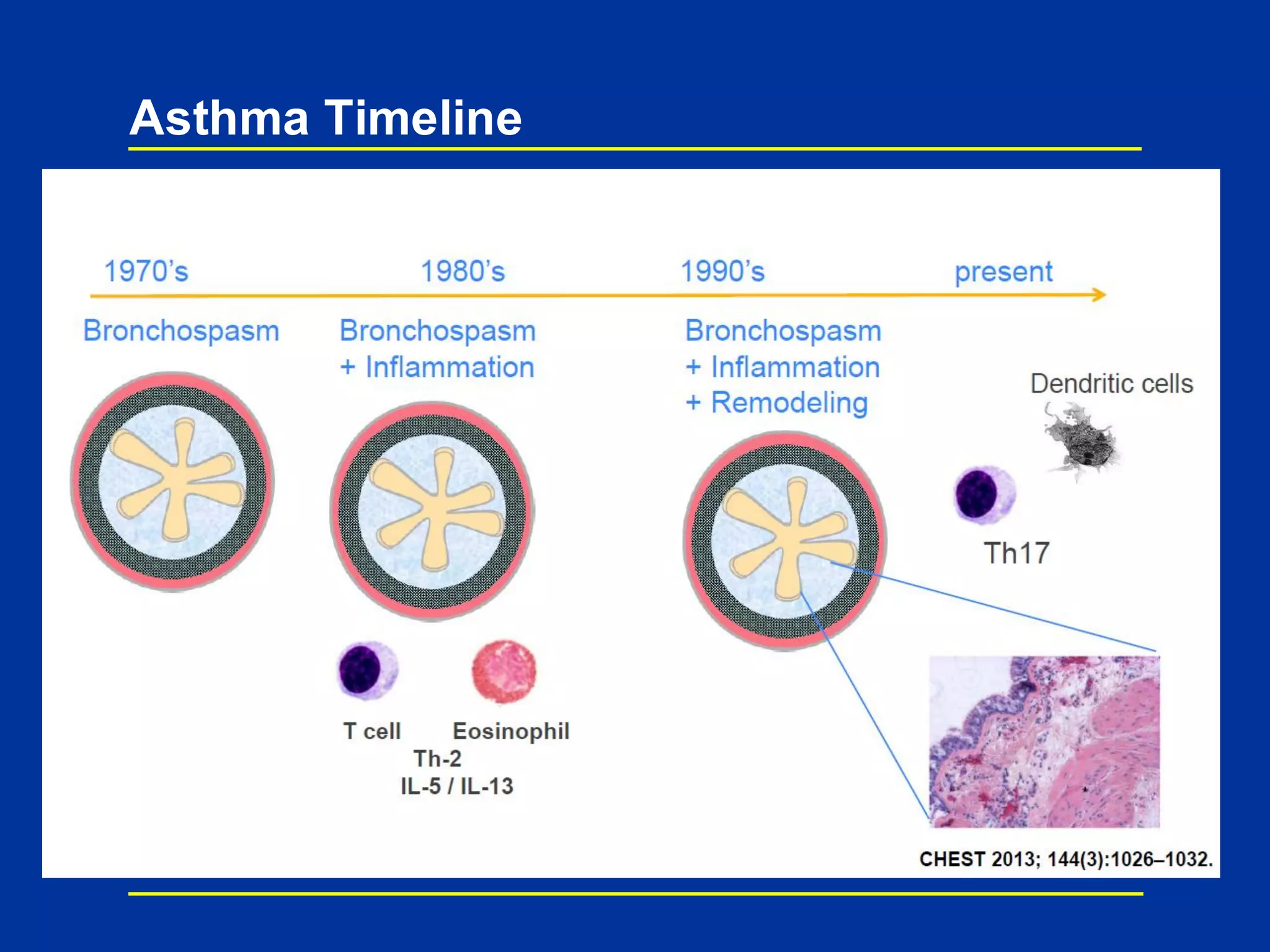 Asthma Timeline
 