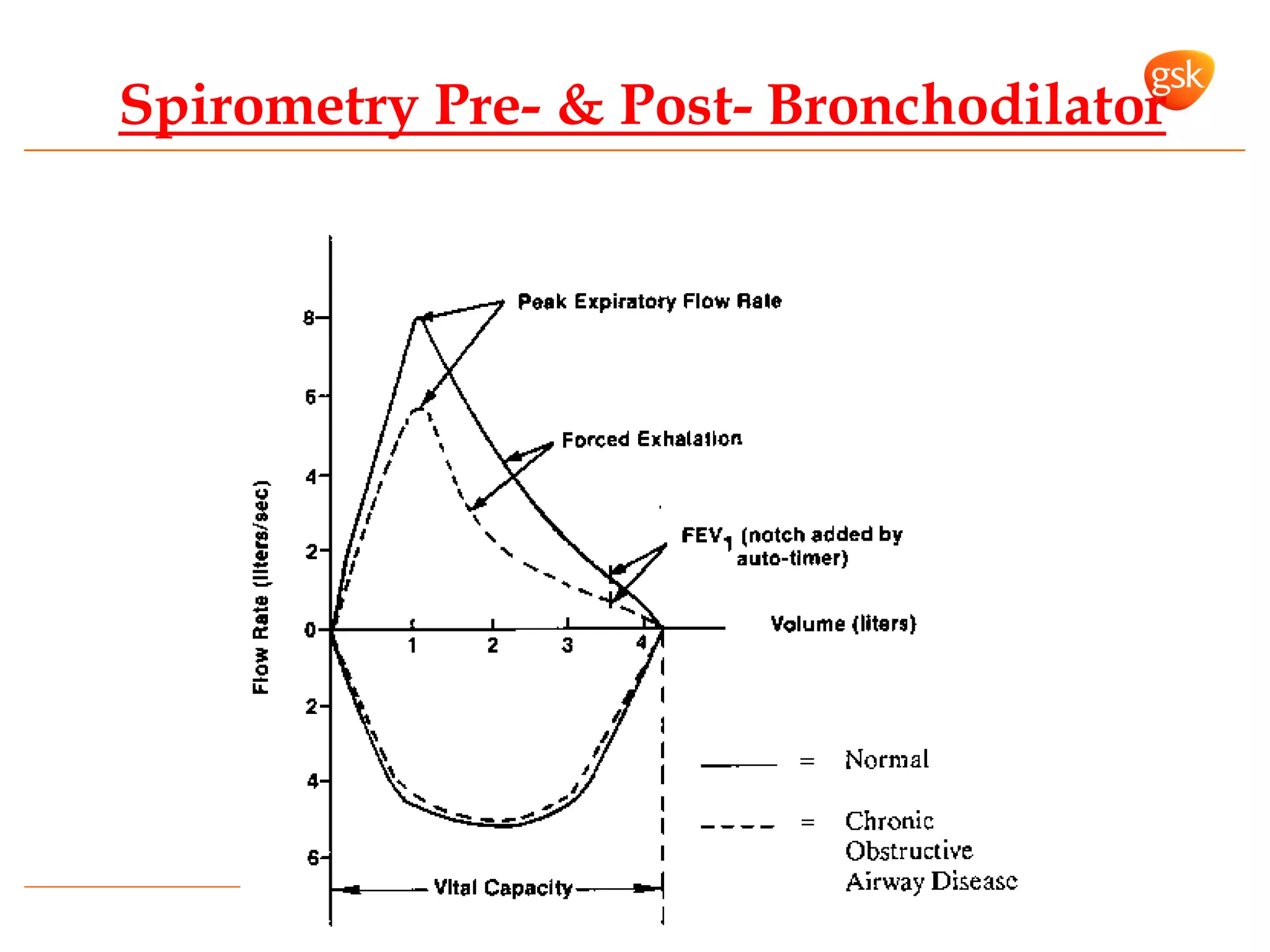 Spirometry Pre- & Post- Bronchodilator
 