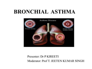 BRONCHIAL ASTHMA
Presenter: Dr P KIREETI
Moderator: Prof T. JEETEN KUMAR SINGH
 