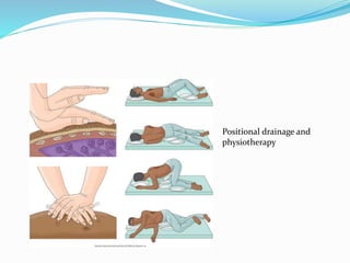 Positional drainage and 
physiotherapy 
 