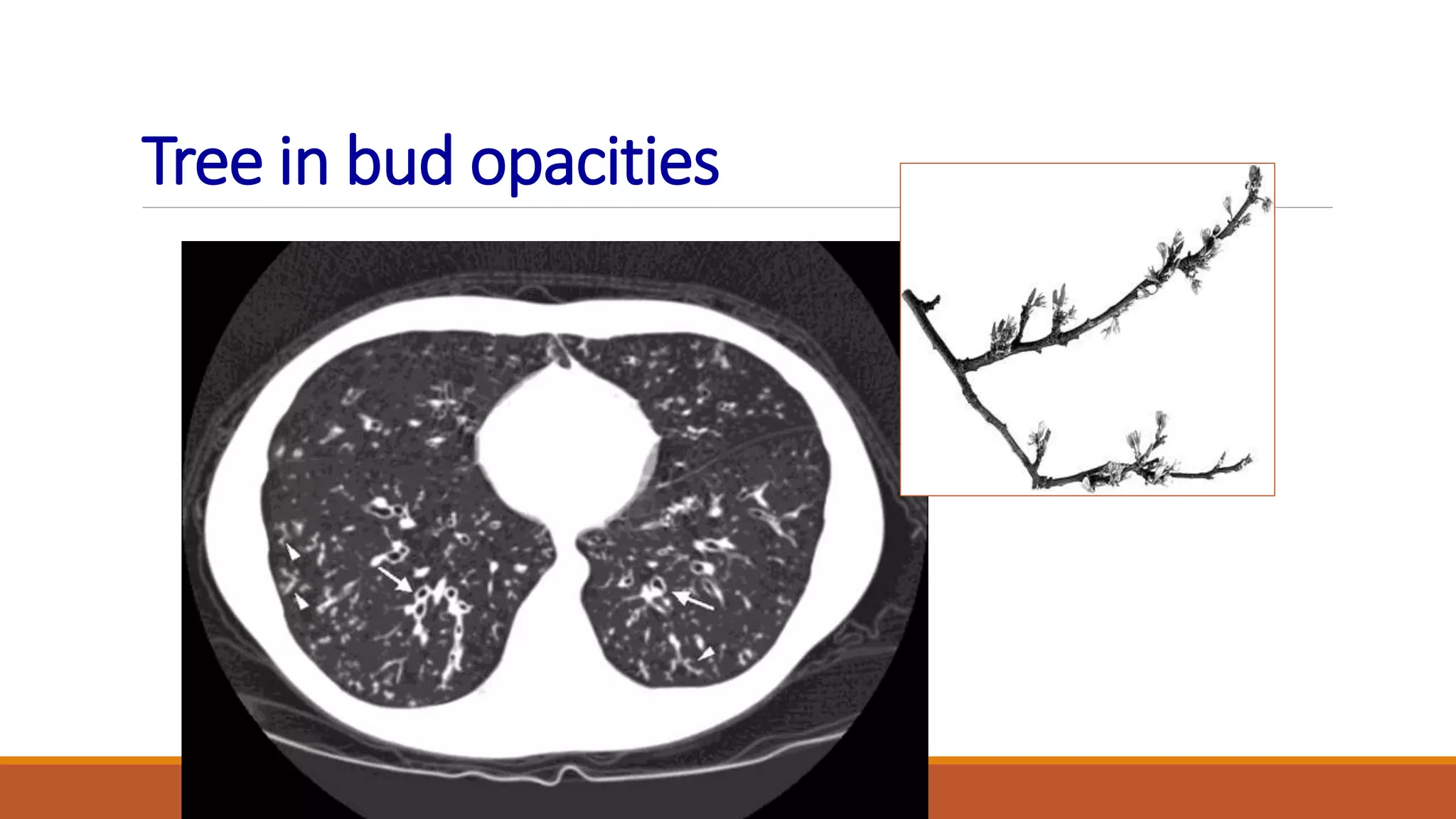 Tree in bud opacities
 