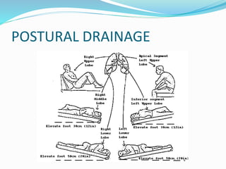 POSTURAL DRAINAGE
 