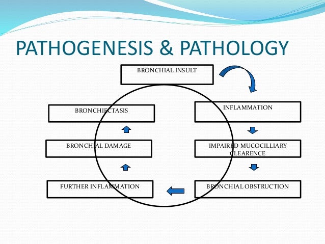 Bronchiectasis.