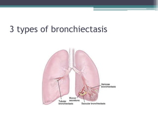 Bronchiectasis | PPTX