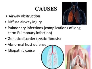 Diffuse Cause BRONCHIECTASIS.pptx