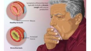 CLINICAL MANIFESTATION
 