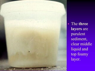    The three
                     layers are
                     purulent
                     sediment,
                     clear middle
                     liquid and
                     top foamy
                     layer.
CSBRP-Dec-2012
 
