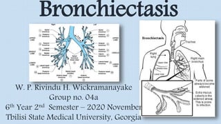 W. P. Rivindu H. Wickramanayake
Group no. 04a
6th Year 2nd Semester – 2020 November
Tbilisi State Medical University, Georgia
Bronchiectasis
 