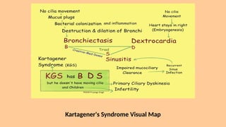 Kartagener's Syndrome Visual Map
 