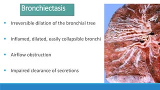 Bronchiectasis
 Irreversible dilation of the bronchial tree
 Inflamed, dilated, easily collapsible bronchi
 Airflow obstruction
 Impaired clearance of secretions
 