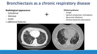 Radiological appearance
- Cylindrical
- Varicose
- Cystic
+ additional features
Clinical syndrome
- Cough
- Sputum production, hemoptysis
- Recurrent infections
- Chronic bacterial colonisation
Bronchiectasis as a chronic respiratory disease
 