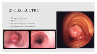 2) OBSTRUCTION
◦ 1) Foreign body obstruction
◦ 2) Endotracheal Tumors
◦ 3) Compression by enlarged lymphnodes
◦ 4) Post inflammatory scarring of bronchi
 