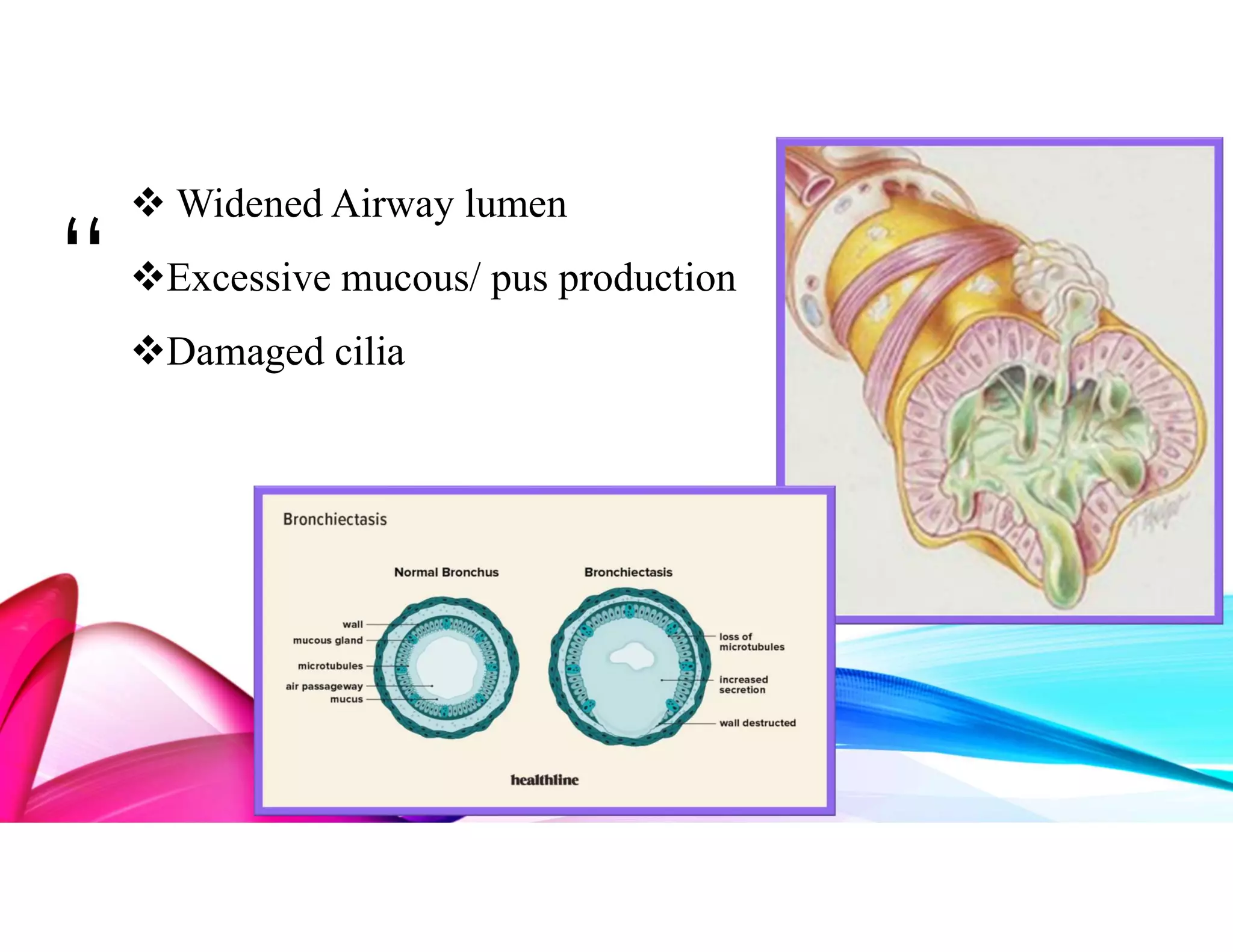 BRONCHIECTASIS PPT .pdf