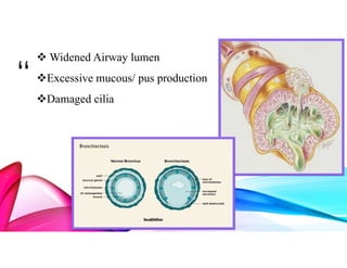 “
”
 Widened Airway lumen
Excessive mucous/ pus production
Damaged cilia
 
