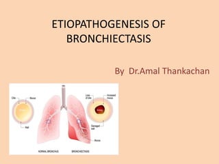 ETIOPATHOGENESIS OF
BRONCHIECTASIS
By Dr.Amal Thankachan
 