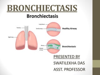 BRONCHIECTASIS
PRESENTED BY
SWATILEKHA DAS
ASST. PROFESSOR
 