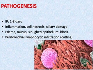 PATHOGENESIS
• IP: 2-8 days
• Inflammation, cell necrosis, ciliary damage
• Edema, mucus, sloughed epithelium: block
• Peribronchial lymphocytic infiltration (cuffing)
 