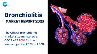 Bronchiolitis
The Global Bronchiolitis
market size registered a
CAGR of 3.90% for the
forecast period 2023 to 2030.
 