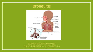 Bronquitis

CARMEN DAMARIS MORALES
CURSO: BIENESTAR Y CALIDAD DE VIDA

 