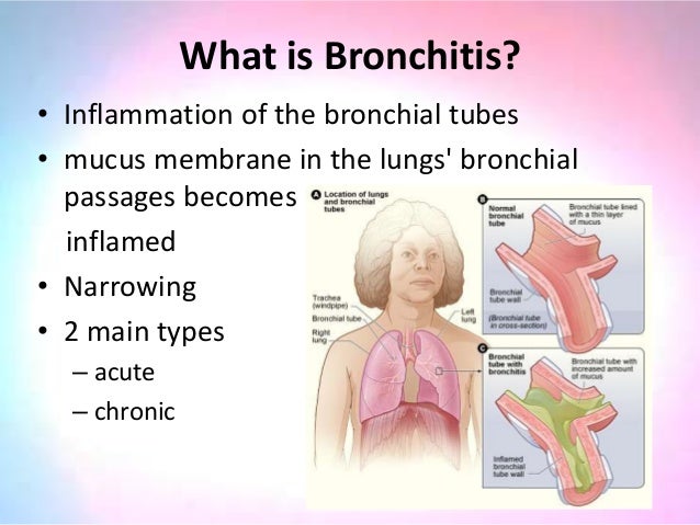 Bronchitis Disease