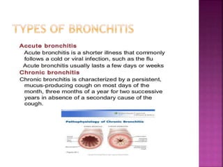 Bronchitis | PPTX