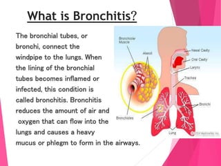 Bronchitis What's The