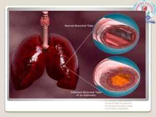 Mr. Sanaket Patel Assistant
Professor MSN Department
Sumandeep Nursing College
Sumandeep Vidyapeeth
 