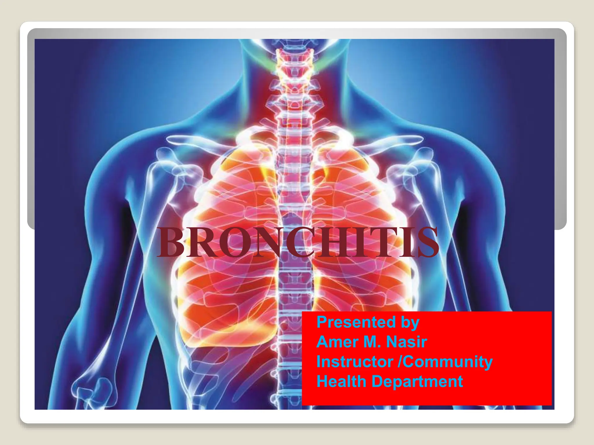 bronchitis Bronchitis is a condition that develops when the airways in