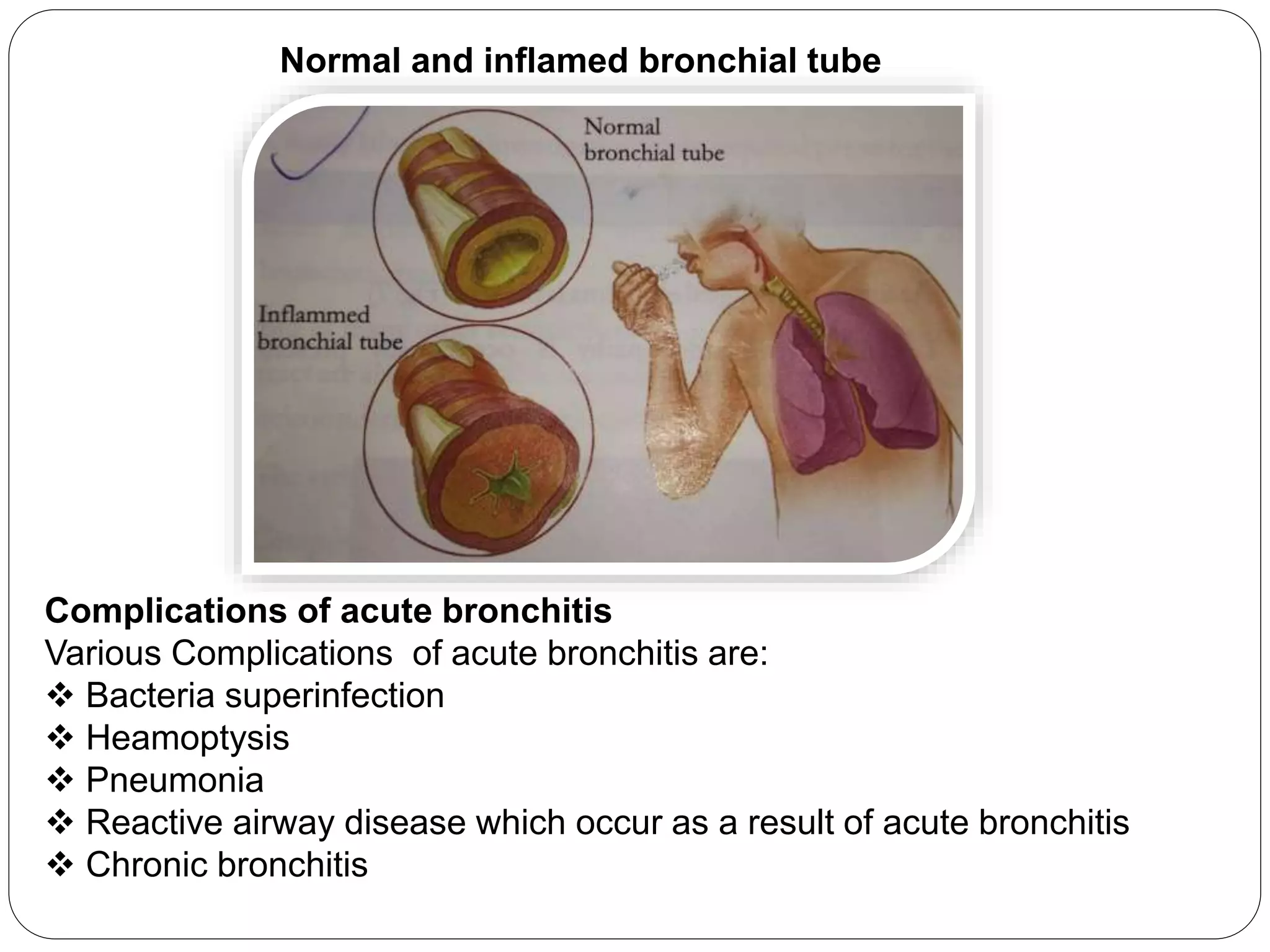 Normal and inflamed bronchial tube
Complications of acute bronchitis
Various Complications of acute bronchitis are:
 Bacteria superinfection
 Heamoptysis
 Pneumonia
 Reactive airway disease which occur as a result of acute bronchitis
 Chronic bronchitis
 