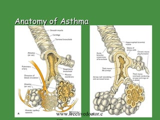 Anatomy of Asthma www.freelivedoctor.com 