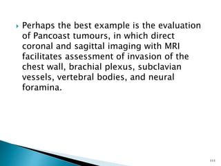  Perhaps the best example is the evaluation
of Pancoast tumours, in which direct
coronal and sagittal imaging with MRI
facilitates assessment of invasion of the
chest wall, brachial plexus, subclavian
vessels, vertebral bodies, and neural
foramina.
111
 