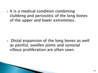  It is a medical condition combining
clubbing and periostitis of the long bones
of the upper and lower extremities.
 Distal expansion of the long bones as well
as painful, swollen joints and synovial
villous proliferation are often seen.
148
 