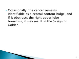  Occasionally, the cancer remains
identifiable as a central contour bulge, and
if it obstructs the right upper lobe
bronchus, it may result in the S-sign of
Golden.
29
 