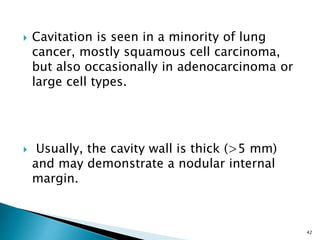  Cavitation is seen in a minority of lung
cancer, mostly squamous cell carcinoma,
but also occasionally in adenocarcinoma or
large cell types.
 Usually, the cavity wall is thick (>5 mm)
and may demonstrate a nodular internal
margin.
42
 