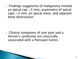  Findings suggestive of malignancy include
an apical cap >5 mm, asymmetry of apical
caps >5 mm, an apical mass, and adjacent
bone destruction.
 Clinical symptoms of arm pain and a
Horner's syndrome are classically
associated with a Pancoast tumor.
49
 