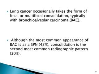  Lung cancer occasionally takes the form of
focal or multifocal consolidation, typically
with bronchioalveolar carcinoma (BAC).
 Although the most common appearance of
BAC is as a SPN (43%), consolidation is the
second most common radiographic pattern
(30%).
52
 