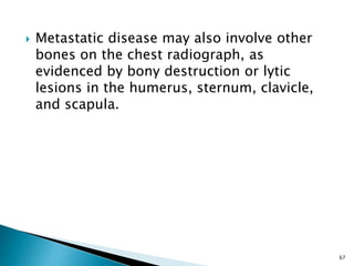  Metastatic disease may also involve other
bones on the chest radiograph, as
evidenced by bony destruction or lytic
lesions in the humerus, sternum, clavicle,
and scapula.
67
 