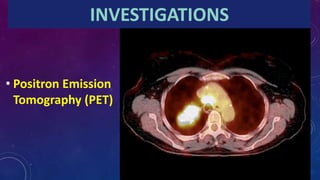 INVESTIGATIONS
• Positron Emission
Tomography (PET)
 