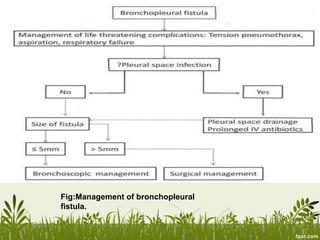 Fig:Management of bronchopleural
fistula.
 