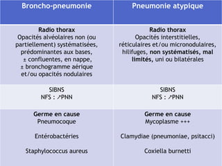 Broncho-pneumonie Pneumonie atypique
Radio thorax
Opacités alvéolaires non (ou
partiellement) systématisées,
prédominantes aux bases,
± confluentes, en nappe,
± bronchogramme aérique
et/ou opacités nodulaires
Radio thorax
Opacités interstitielles,
réticulaires et/ou micronodulaires,
hilifuges, non systématisés, mal
limités, uni ou bilatérales
SIBNS
NFS : ↗PNN
SIBNS
NFS : ↗PNN
Germe en cause
Pneumocoque
Entérobactéries
Staphylococcus aureus
Germe en cause
Mycoplasme +++
Clamydiae (pneumoniae, psitacci)
Coxiella burnetti
 