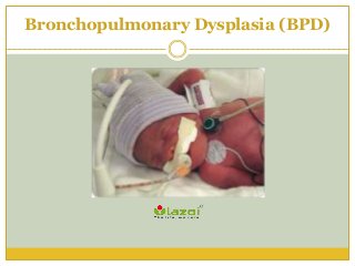 Bronchopulmonary Dysplasia (BPD)
 