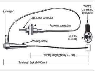 Bronchoscopy Stack Bronchoscopy | PPTX