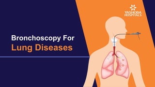 Bronchoscopy For
Lung Diseases
 