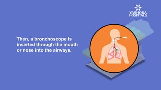 Then, a bronchoscope is
inserted through the mouth
or nose into the airways.
 